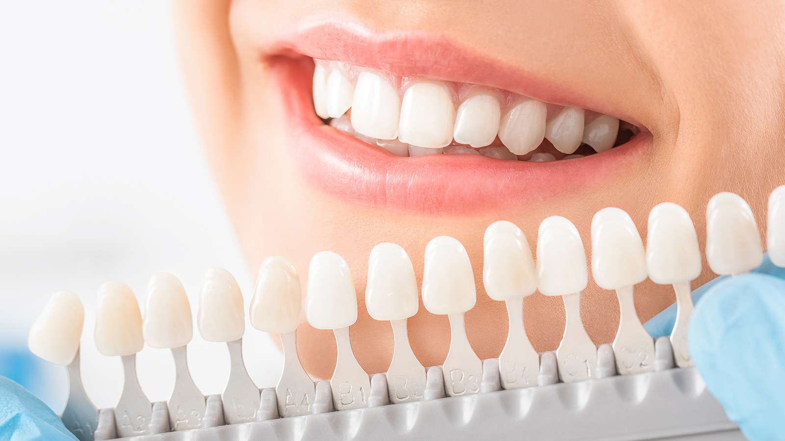 Blanchiment dentaires soin cabinet dentiste Savoie