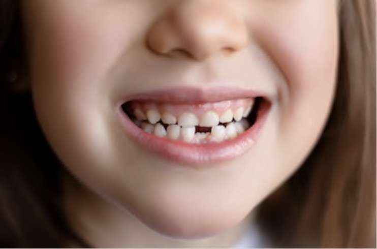 Enfant dent pousse cabinet dentaires des savoies